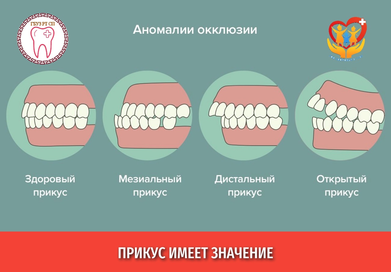 Что нужно для формирования здорового и правильного прикуса у детей?